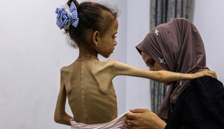 مستشفيات غزة تسجل حالتي وفاة بسبب المجاعة وسوء التغذية خلال یوم