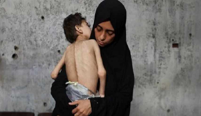 يونيسف: أكثر من 5 آلاف طفل بغزة أصيبوا بسوء التغذية خلال 15 يوما