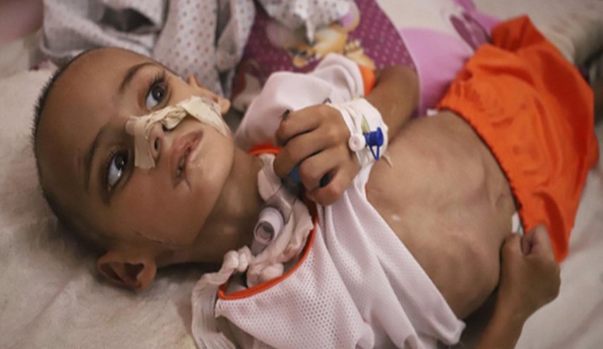 ماذا تعرف عن متلازمة 