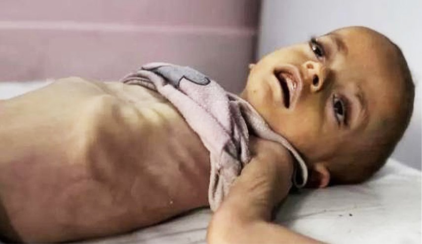 أكثر من 500 ألف طفل دون الخامسة مهددون بالموت