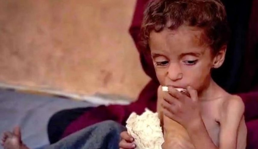 سوء تغذیه شدید ۴۰هزار کودک در نوار غزه/ تهدید زندگی معلولان