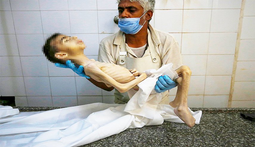 التجويع الإحتلال لغزة يقتل 11 فلسطينيا والحصيلة ترتفع إلى 300