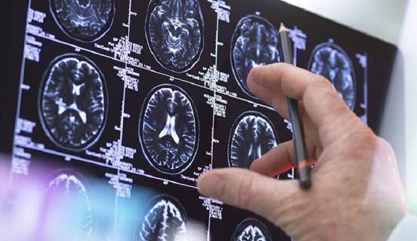 علامات تدل على أورام الدماغ