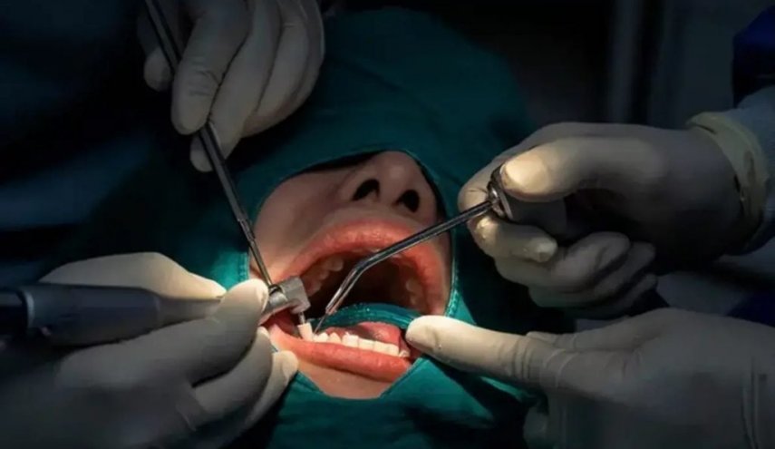 إيران تطور إسفنجة نانوية مبتكرة لجراحات الأسنان