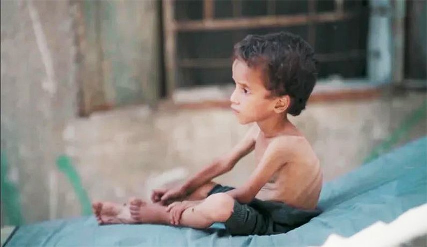 مستشفى 'شهداء' الأقصى: الاحتلال يمارس التجويع بحق سكان غزة