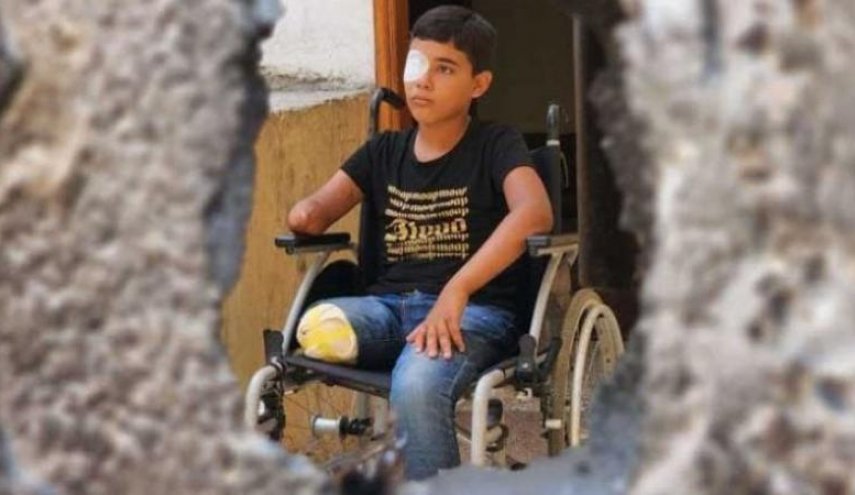 6000 حالة بتر بحاجة لبرامج تأهيل عاجلة في غزة