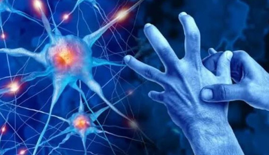 اختبار رسم بسيط قد يكشف مؤشرات باركنسون بدقة مذهلة