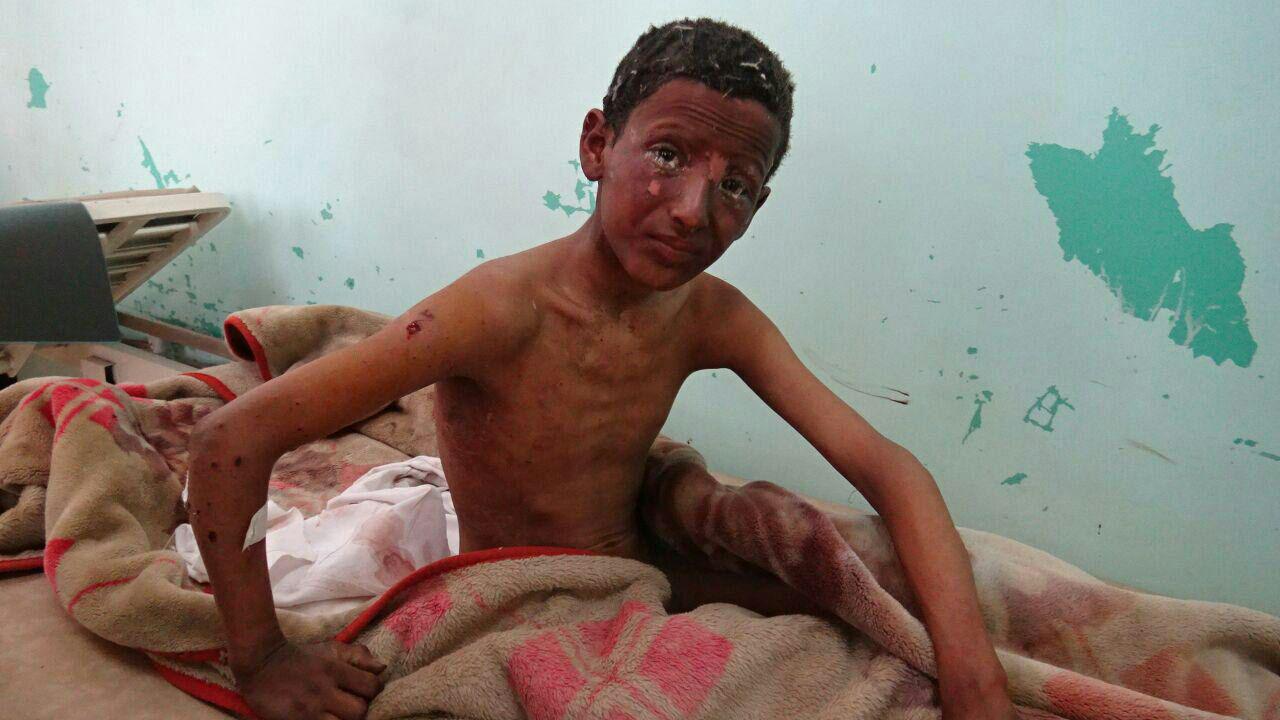 تصاویری از جنایت هولناک ائتلاف سعودی در الجوف یمن