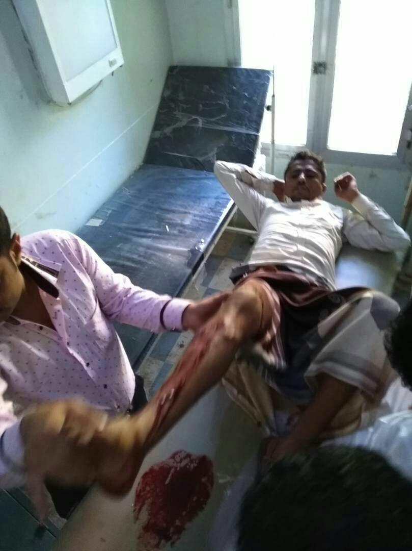 بالصور.. محاولة اغتيال أحد أقرباء نائب يمني تبوء بالفشل