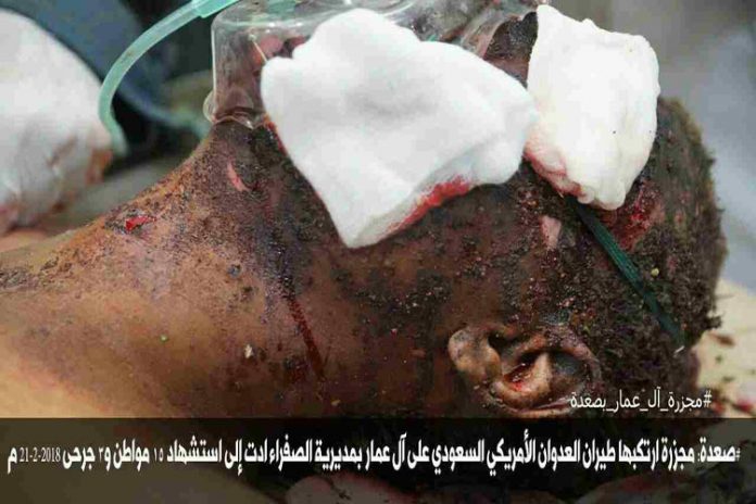 بالصور.. مجزرة بشعة للعدوان باستهداف سيارات أجرة قرب صنعاء