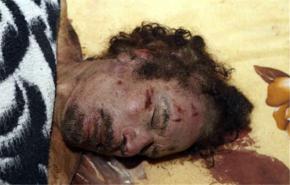 المجلس الانتقالي يؤكد تشريح جثة القذافي