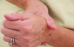 إيران تنتج دواءً تحتكره أمريكا لعلاج التهاب المفاصل