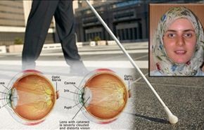 عالمة ايرانية تكتشف أسلوبا جديدا لعلاج العمى