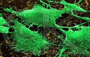 الكشف عن بكتيريا مضادة للسرطان بتربة ايران
