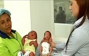 تولد نوزاد 5 كيلويي در كلمبيا