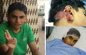 اصابة فتى سعودي برصاص قوات النظام بالعوامية