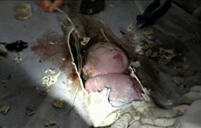 فیلم نجات نوزاد از داخل لوله فاضلاب