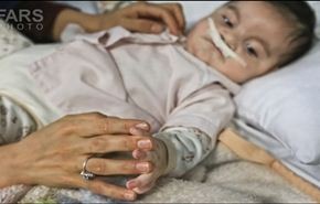 نذور الاطباء الإيرانيين تنقذ 36 مريضا من الفقراء