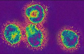 ارتفاع حصيلة ضحايا كورونا لـ169 شخصا بالسعودية