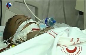 كاميرا العالم تكشف جرائم الاحتلال الاسرائيلي ضد اطفال غزة+فيديو