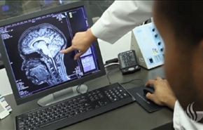 التعافي من الجلطة الدماغية