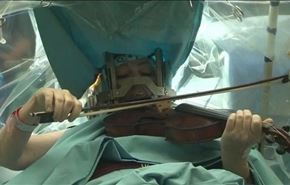 بالفيديو..تعزف على الكمان وهي تخضع لعملية جراحية في دماغها