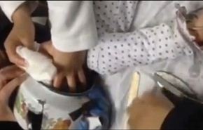 بالفيديو/ تحرير راس طفلة علق داخل إبريق شاي
