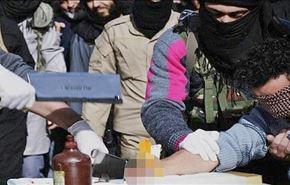 داعش دست یک سوری را قطع کرد + عکس