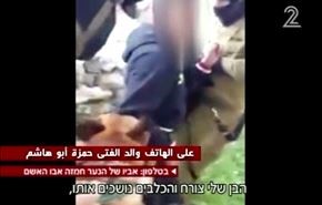 حمله سگ اسرائیلی به پسربچه فلسطینی + فیلم
