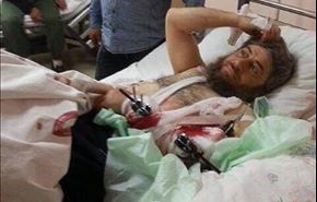 درمان یکی از سران داعش در بیمارستان ترکیه‌ای