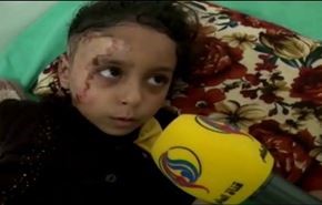 جراحات كودكان يمنی، از جنایتی هولناک پرده برداشت + فیلم