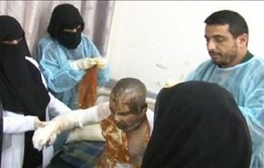 تاکید پزشکان یمنی بر وجود مواد شیمیایی در سلاح‌ها +ویدئو