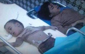 شيخ الاسلام: منع المساعدات الانسانية عن اليمنيين جريمة