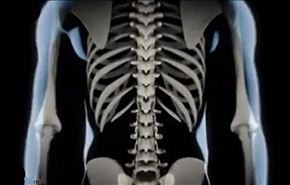 هشاشة العظام تزيد مخاطر الصمم المفاجئ
