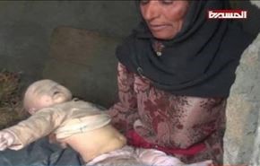 خودکشی خلبان سعودی پس از مشاهده تصاویر اجساد کودکان یمنی