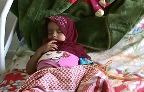 گزارش تصویری العالم از وضعیت بیماران سرطانی یمن