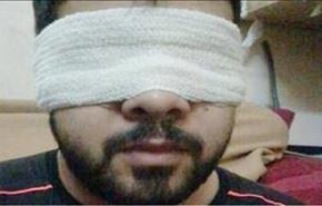 زندانی بحرینی بینایی خود را از دست داد