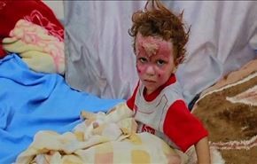 بهداشت جهانی: 4300 نفر در یمن قربانی شدند