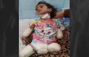 جرائم حرب وابادة يرتكبها العدوان السعودي في صنعاء