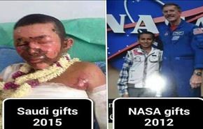 سعودی ها کودک یمنی برنده جایزه ناسا را سوزاندند!