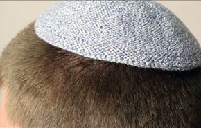 هل تعرف سبب وضع اليهود قبعة صغيرة على رؤوسهم!