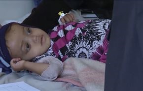 الأمم المتحدة: 113 يمنيا يموتون يوميا بسبب الحصار