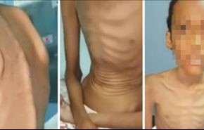 فيديو مؤلم.. سعودية منعت اطفالها من الغذاء لسنوات لهذا السبب!
