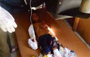 بالفيديو: إجرام العدوان يصل لحد استهداف المستشفيات والمدارس باليمن!