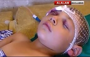 ویدیو: حمله به کودکان محاصره‌شده شیعه در سوریه