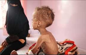 منظمة الصحة العالمية تعلن انتشار الكوليرا في اليمن