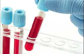 شناسایی بیش از 23 گروه خونی نادر در کشور