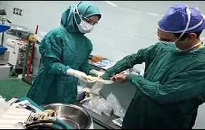 متى يلجأ الاطباء الى عملية القلب المفتوح؟