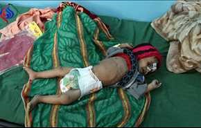 فيديو/ اليونيسف تكشف ارقاما جديدة عن معاناة اطفال اليمن بسبب العدوان