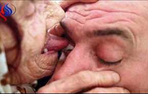 عجوز بوسنية تستخدم لسانها لعلاج مرضاها من العمى